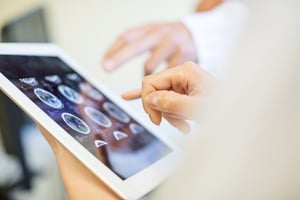 close-up-of-medical-professionals-looking-at-mri-scans-on-tablet